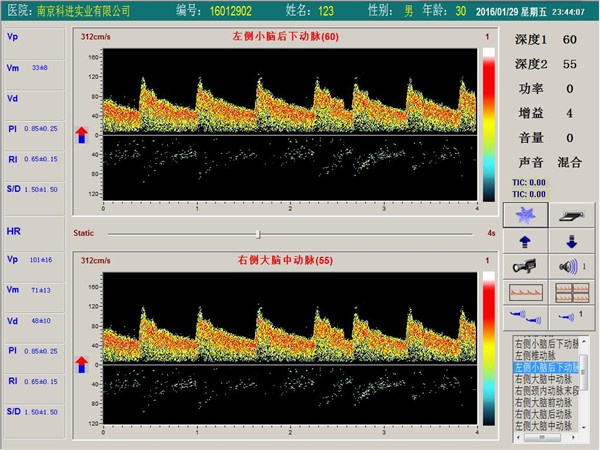 經(jīng)顱多普勒雙通道，單深度界面