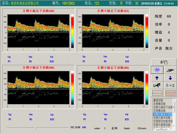 經(jīng)顱多普勒單通道，四深度界面