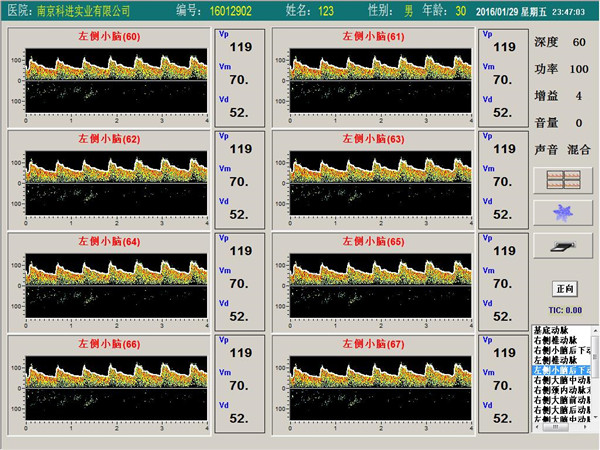 經(jīng)顱多普勒單通道，八深度界面