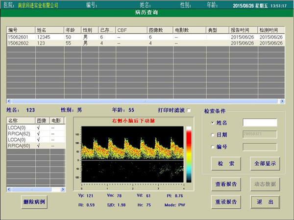 經(jīng)顱多普勒?qǐng)?bào)告查詢界面.jpg