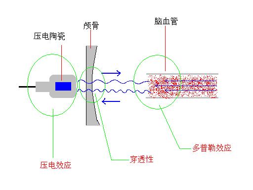 工作原理1.jpg