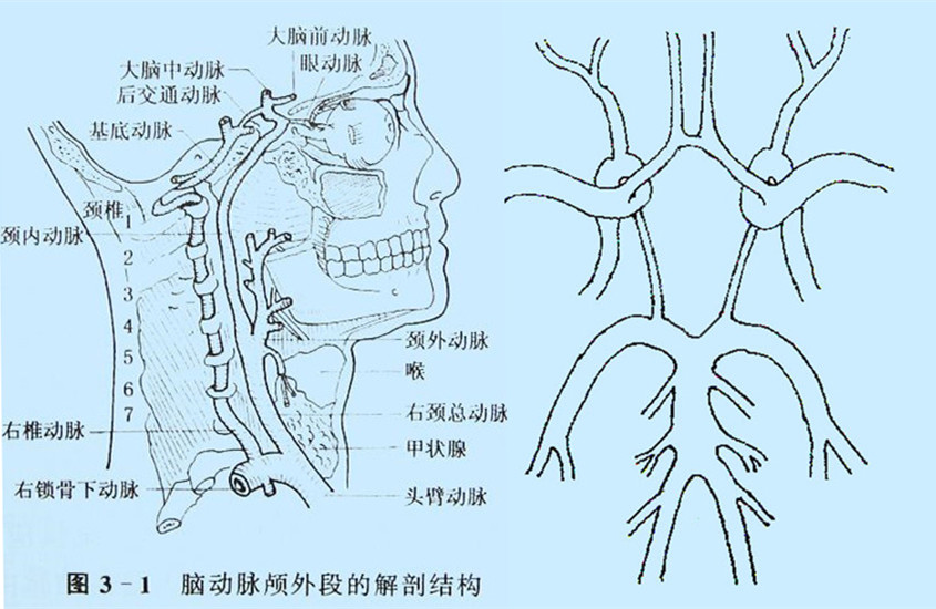 腦動脈顱外段的右側面圖Willis環(huán)的模擬圖.jpg