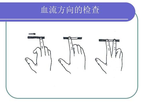 超聲經(jīng)顱多普勒對顱內(nèi)血流方向的檢查