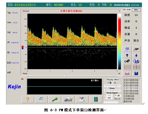 經(jīng)顱多普勒軟件PW模式下單窗口檢測(cè)界面