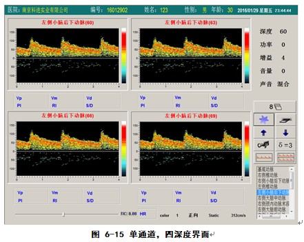 經(jīng)顱多普勒軟件單通道四深度檢測(cè)界面