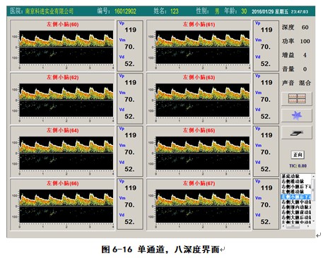 經(jīng)顱多普勒軟件單通道八深度檢測(cè)界面